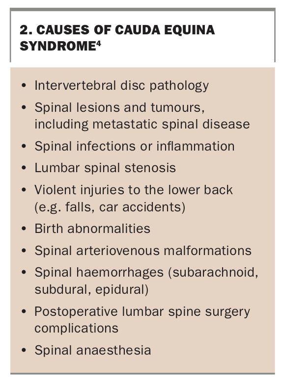 Beware The Cauda Equina Not Just Another Low Back Pain Medicine Today